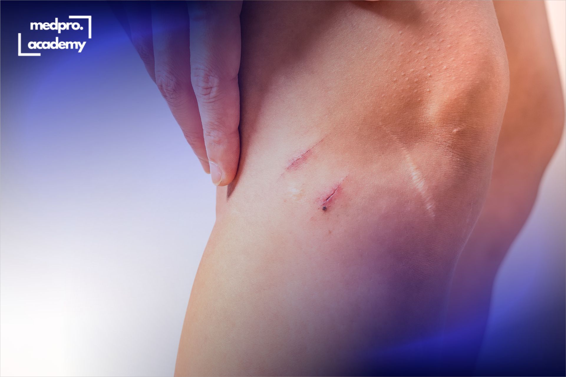 1Рубці шкіри сучасні аспекти діагностики та лікування